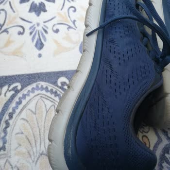 Skechers Umursamazlığı Bir Daha Asla Almam