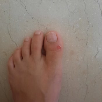 FLO Ayakkabı Kalitesiz Terlik (Nine West) Parmaklarım Yara İçinde