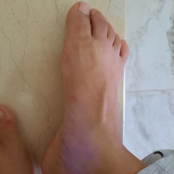 FLO Ayakkabı Kalitesiz Terlik (Nine West) Parmaklarım Yara İçinde