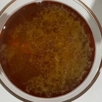 Hamilelikte Yaşanan Fuse Tea Sorunu