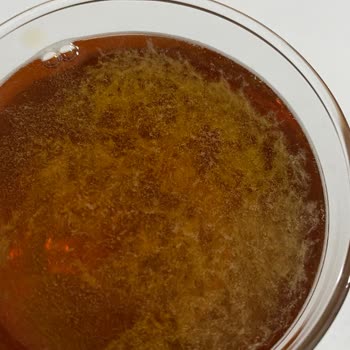 Hamilelikte Yaşanan Fuse Tea Sorunu
