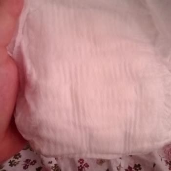 Molfix Bezlerde Sızdırma Sorunu