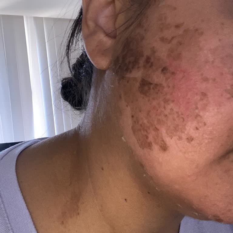 Deluxe Vip Güzellik Merkezi'nde Hayal Kırıklığı!