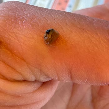 Makarna Lütfen Aldığım Ürünümden Böcek Çıktı