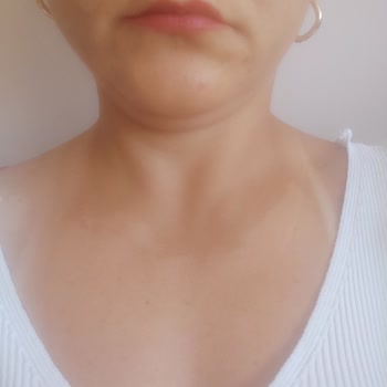 Eda Taşpınar Yağ Ve Güneş Kremi