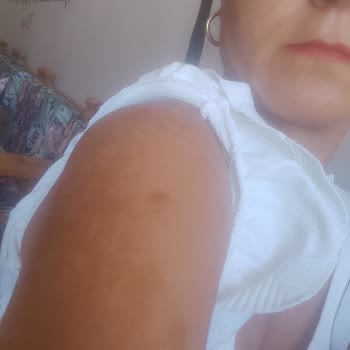 Eda Taşpınar Yağ Ve Güneş Kremi