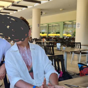 Eda Taşpınar Yağ Ve Güneş Kremi