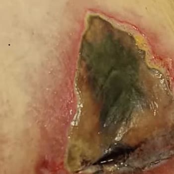 Zelal Odak Huzurevi ve Yaşlı Bakım Evi Yaşlı Bakımevinde Yaşanan Sorunlar