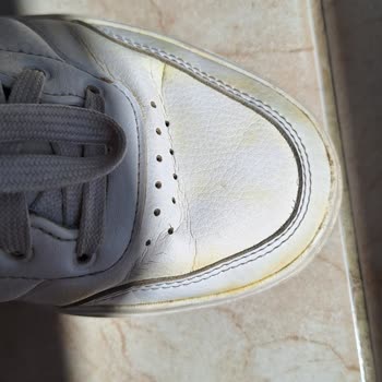 Adidas Markalı Ayakkabının Durduk Yere Sararması
