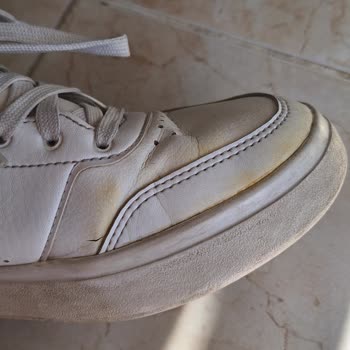 Adidas Markalı Ayakkabının Durduk Yere Sararması
