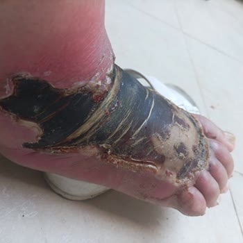 Özel Florya Hastanesi Florya Hastanesi İhmal Ve İlgisizlik