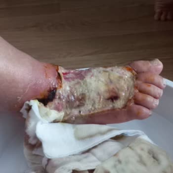 Özel Florya Hastanesi Florya Hastanesi İhmal Ve İlgisizlik