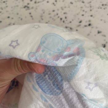 Molfix Bez İçinde Sert Bir Kitle