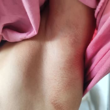 Decathlon Çocuk Kolluklarının Kalitesizliği