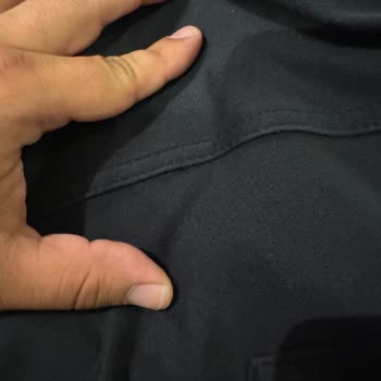 Network Pantolon Arka Kısmından Açılma Yaptı Mağaza Yardımcı Olmuyor