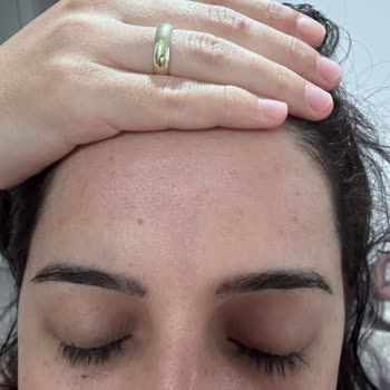 Gratis Green Therapy Saç Boyası Sağlık Sorunlarına Yol Açtı