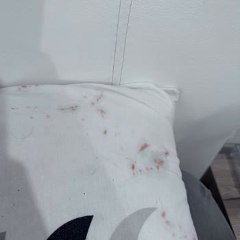 Gratis Green Therapy Saç Boyası Sağlık Sorunlarına Yol Açtı