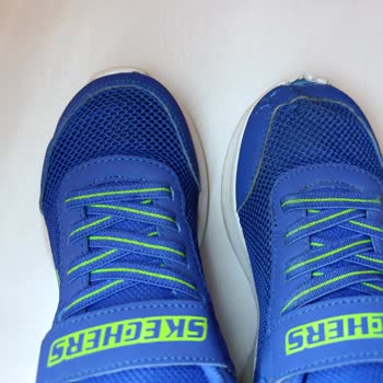 Skechers Kids Ayakkabı Yırtıldı