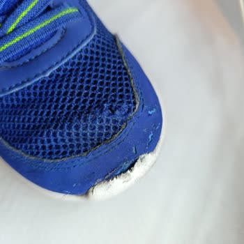 Skechers Kids Ayakkabı Yırtıldı