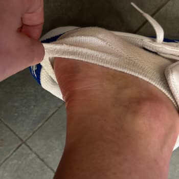 Adidas Markasının En Kötü Ayakkabısı