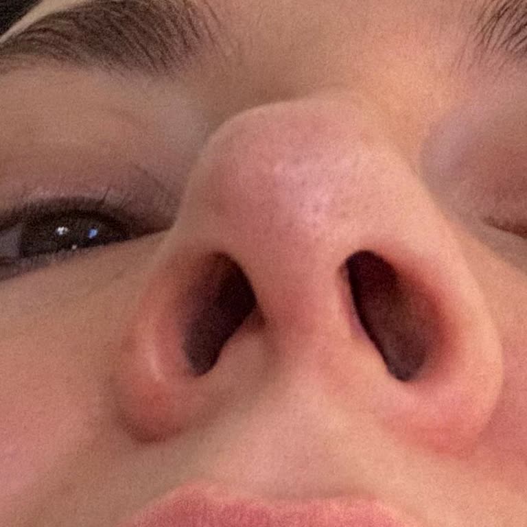 Op. Dr. Hakan Çepni Nasen-OP schlechte Erfahrung und mangelnde Betreuung danach