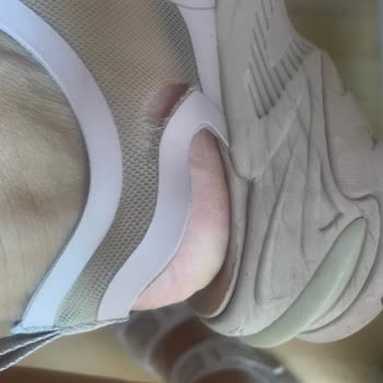 Skechers Sandalete Sahip Çıkmıyor. Üç Ayda Üç Yerinden Yırtıldı.