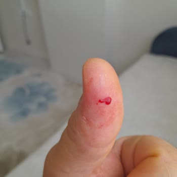 Altus Derin Dondurucu Elimi Kesti