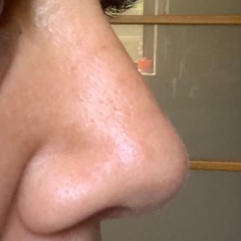 Aile Hastanesi Hastane Deneyimi Ve İlgisizlik Üzerine Değerlendirme