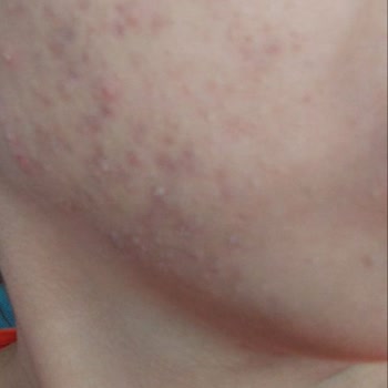 Dilan Polat Antep Merkez Rasaf Yolu Şubesi 'nin Yaşattığı Mağduriyet