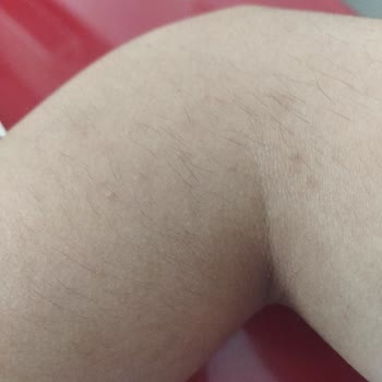 Dilan Polat Antep Merkez Rasaf Yolu Şubesi 'nin Yaşattığı Mağduriyet