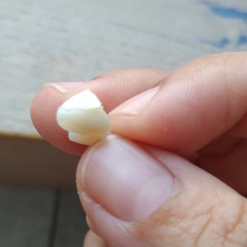 Beyaz Işık Ağız Ve Diş Sağlığı Kaplamam Düştü Mağdur Oldum!