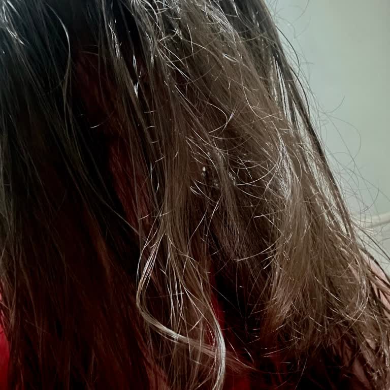 Gratis Ürünü Saçıma Zarar Verdi