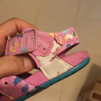 Skechers Sandalet Derisi Kopuyor
