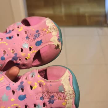 Skechers Sandalet Derisi Kopuyor