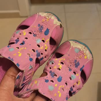 Skechers Sandalet Derisi Kopuyor