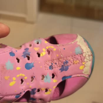 Skechers Sandalet Derisi Kopuyor