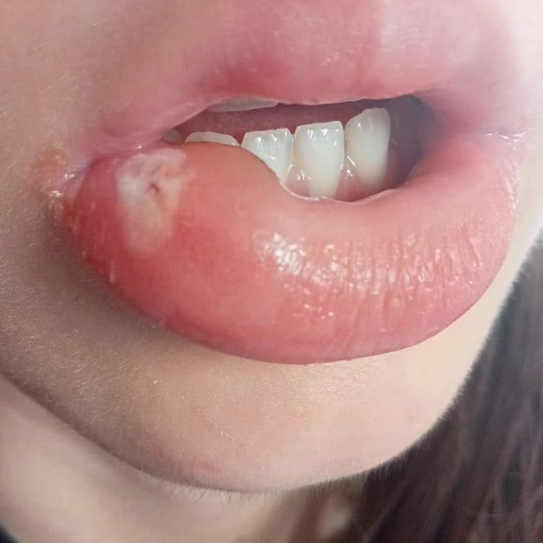 Baydent Ağız Ve Diş Sağlığı Polikliniği Baydent Diş Kliniği!