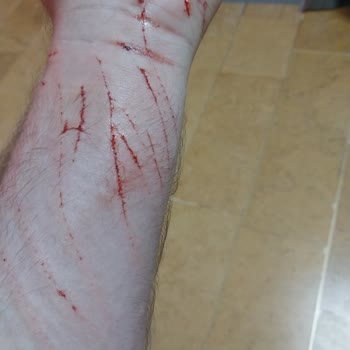 Kapaklı Devlet Hastanesi Haksız Para Talebi!