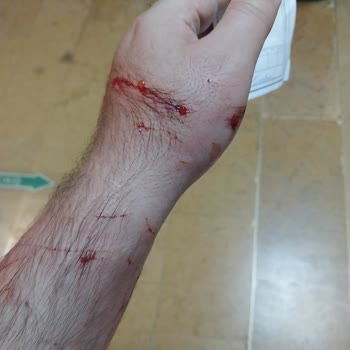 Kapaklı Devlet Hastanesi Haksız Para Talebi!