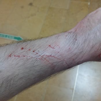 Kapaklı Devlet Hastanesi Haksız Para Talebi!