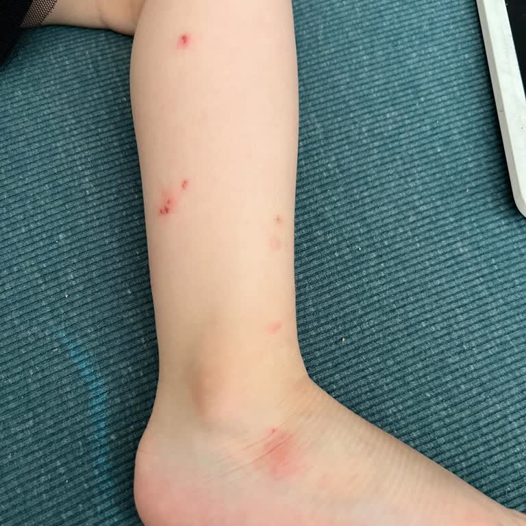 Bahçelievler Belediyesi Bahçelievler Sivrisinek Sıkıntısı