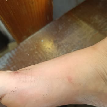 Adidas Marka Terlik Sorunu!...