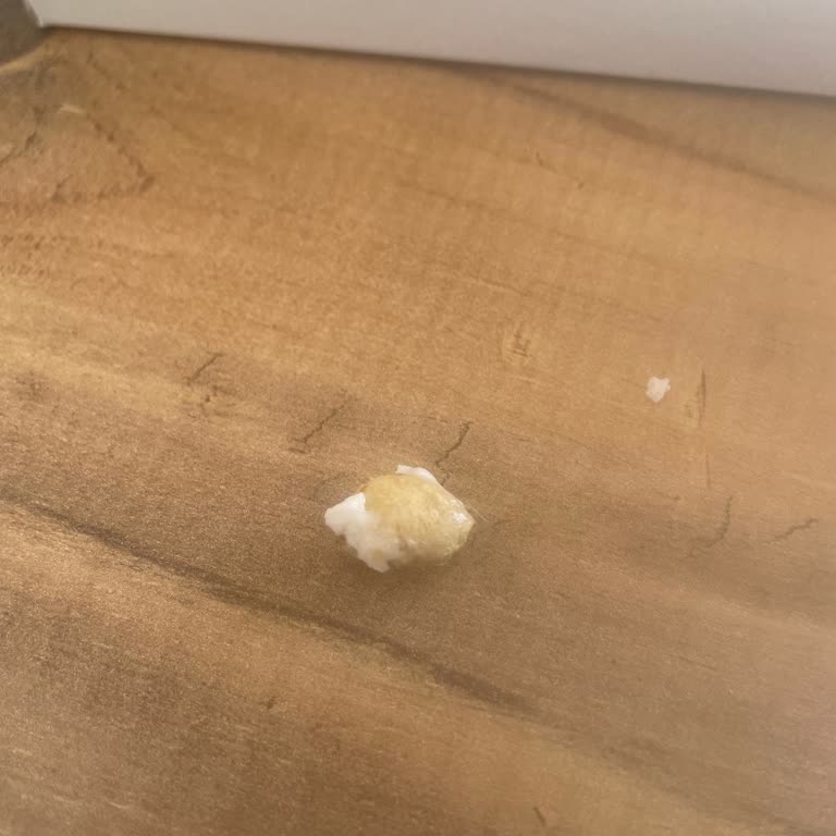 Alko Şekerleme Lokumun İçerisinden Çekirdek Çıktı