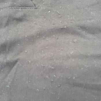 Lovelet İkiler Tüylenme Şikayeti