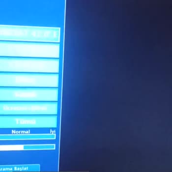 TRT 1 Yayın Kötülüğü Neden?