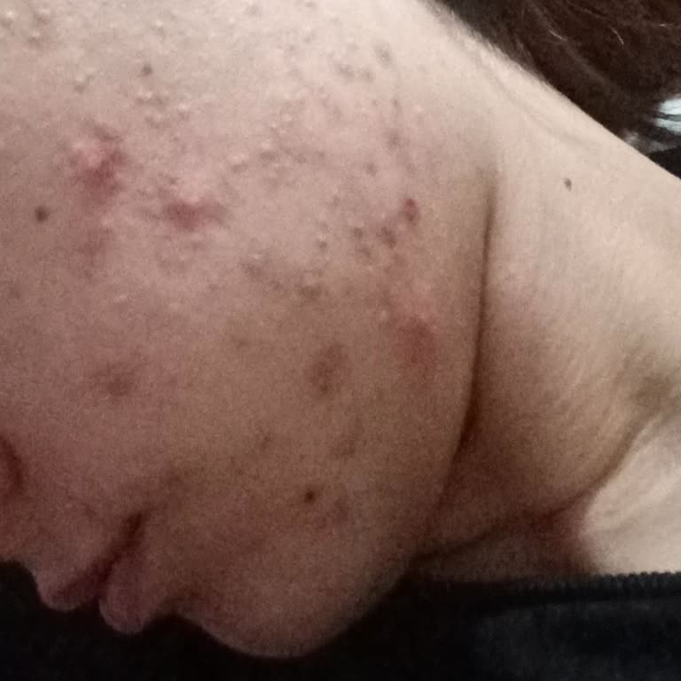 Blue Diamond Zonguldak Şubesinden Şikayetçiyim