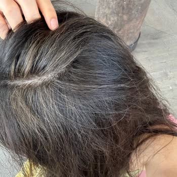 Garage Hair Repair Studio Saçlarımı Mahvettiler!