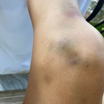 Haydi Kampa Hijyen Sorunları Ve Güvenlik İhmalleri İle Mahvolan Tatil