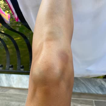 Haydi Kampa Hijyen Sorunları Ve Güvenlik İhmalleri İle Mahvolan Tatil