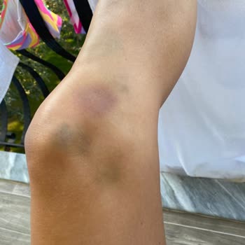 Haydi Kampa Hijyen Sorunları Ve Güvenlik İhmalleri İle Mahvolan Tatil